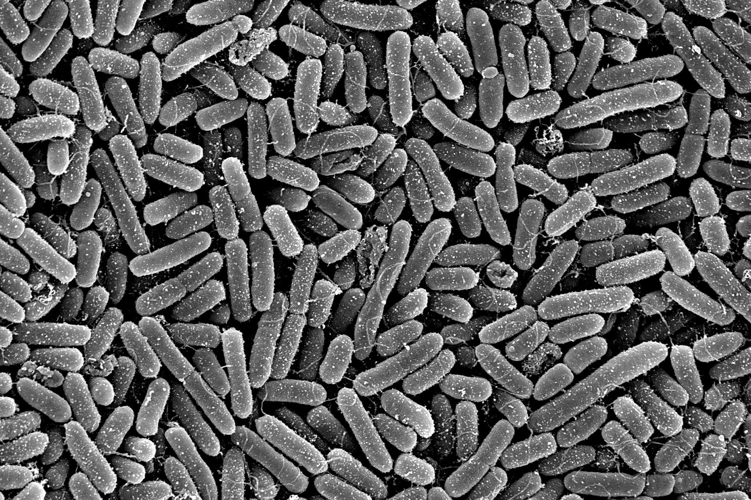 Elektronenmikroskopische Aufnahme von Pseudomonas aeruginosa 