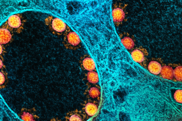 Bild einer infizierten Zelle der Riechschleimhaut